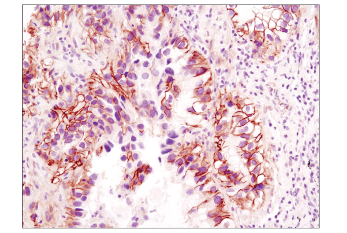 undefined Image 33: Cadherin-Catenin Antibody Sampler Kit