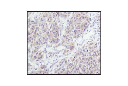 Immunohistochemistry Image 3: Akt (pan) (11E7) Rabbit mAb
