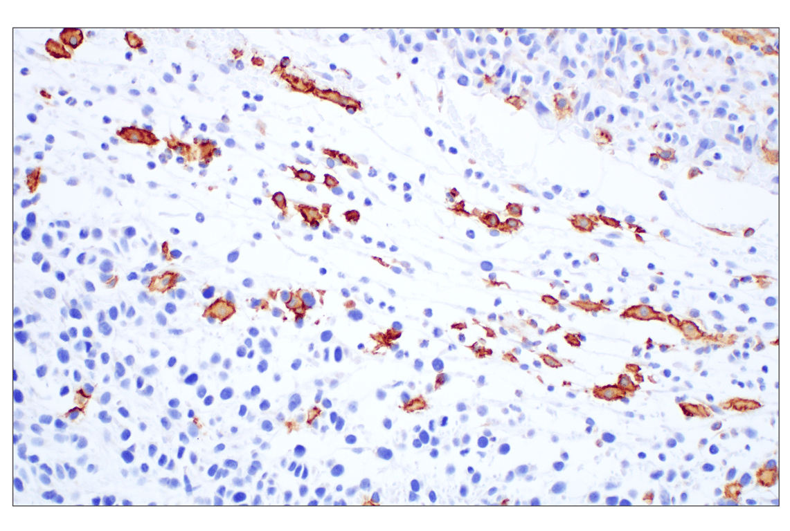 Immunohistochemistry Image 1: Siglec-1/CD169 (E1D7G) Rabbit mAb