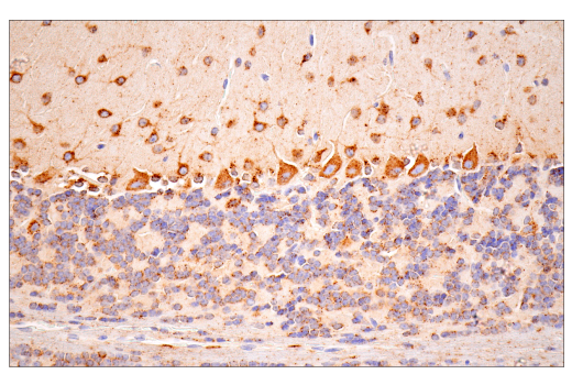 Immunohistochemistry Image 6: Cathepsin D (E7Z4L) XP<sup>®</sup> Rabbit mAb