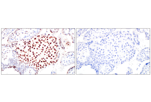 Immunohistochemistry Image 6: C/EBPβ (E2K1U) Rabbit mAb (BSA and Azide Free)