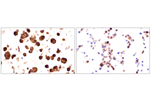 Immunohistochemistry Image 7: CDK2 (E8J9T) XP<sup>®</sup> Rabbit mAb (BSA and Azide Free)
