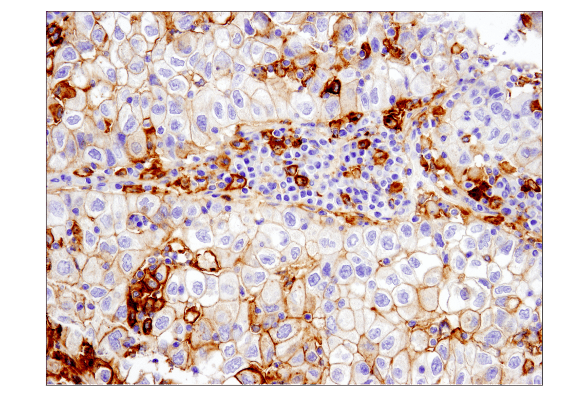 Immunohistochemistry Image 1: PD-L1 (E1L3N<sup>®</sup>) XP<sup>®</sup> Rabbit mAb (BSA and Azide Free)