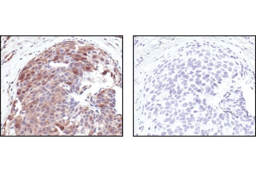 Immunohistochemistry Image 1: Phospho-(Ser/Thr) Akt Substrate Antibody