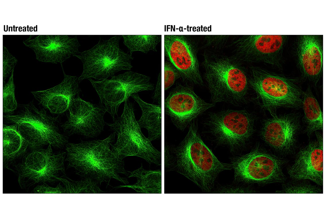 Immunofluorescence Image 1: Phospho-Stat1 (Tyr701) (58D6) Rabbit mAb (Alexa Fluor® 555 Conjugate)