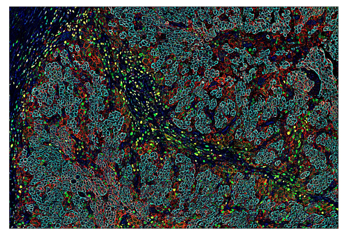 Immunohistochemistry Image 7: TCF1/TCF7 (C63D9) & CO-0006-594 SignalStar<sup>™</sup> Oligo-Antibody Pair