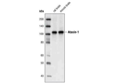 Western Blotting Image 1: Ataxin-1 Antibody
