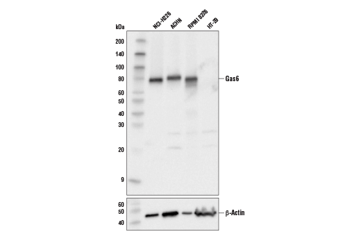 Western Blotting Image 1: GAS6 (D3A3G) Rabbit mAb (BSA and Azide Free)