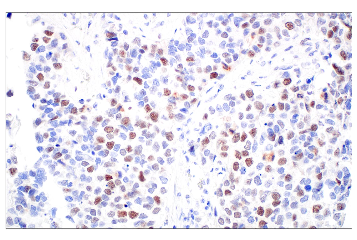 Immunohistochemistry Image 7: BRCA1 (E5S9G) Rabbit mAb