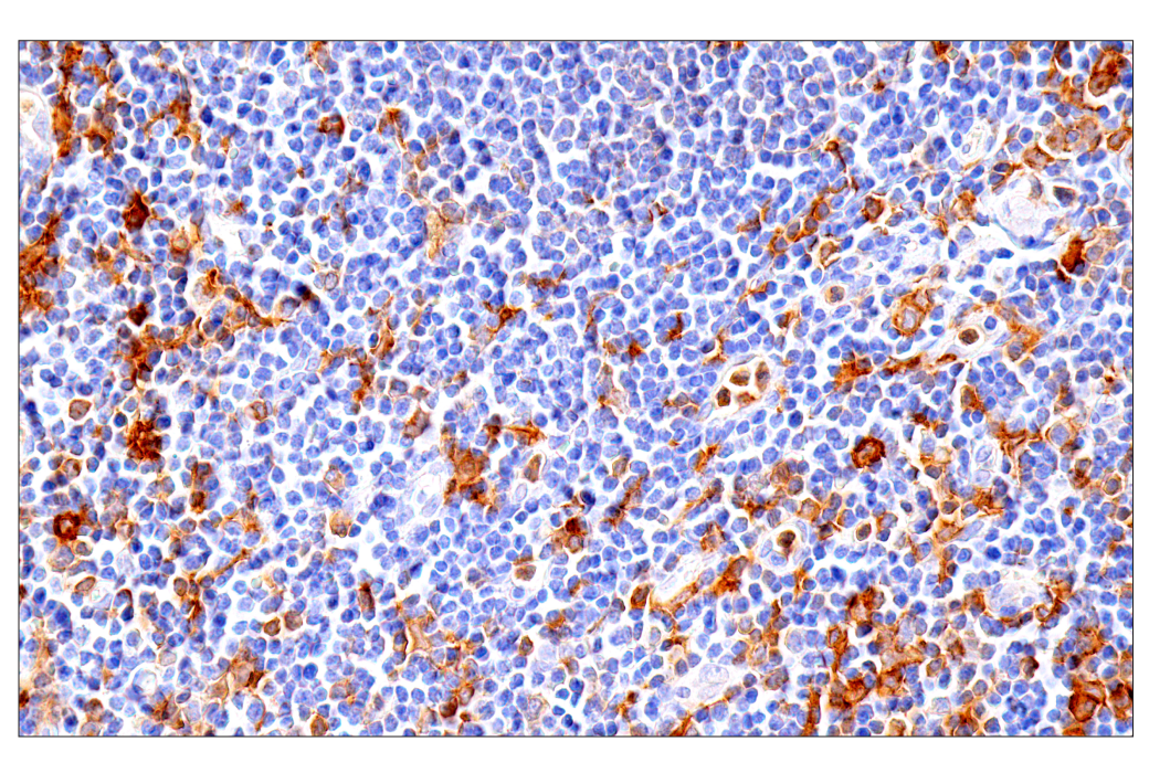 Immunohistochemistry Image 5: GM-CSF Receptor α (E8Z3S) Rabbit mAb