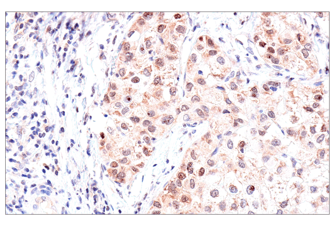 Immunohistochemistry Image 3: ADAR1 p150 Isoform   (E6U1U) Rabbit mAb   (BSA and Azide Free)