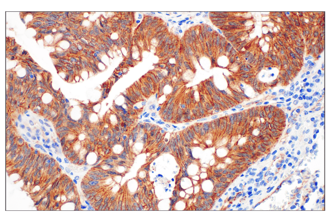 undefined Image 23: Cadherin-Catenin Antibody Sampler Kit