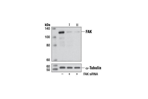 undefined Image 1: SignalSilence<sup>®</sup> FAK siRNA I