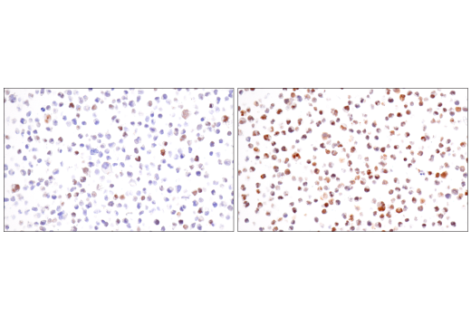 Immunohistochemistry Image 11: HIF-1α (E1V6A) Rabbit mAb