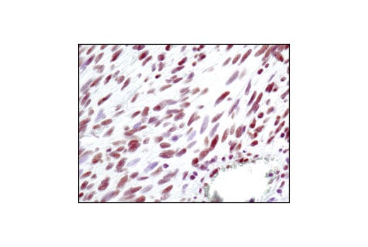 undefined Image 19: Non-Homologous End Joining (NHEJ) DNA Repair Antibody Sampler Kit