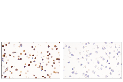 Immunohistochemistry Image 8: CD54/ICAM-1 (E3Q9N) XP<sup>®</sup> Rabbit mAb