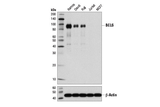 Western Blotting Image 1: BCL6 (D4I2V) XP® Rabbit mAb