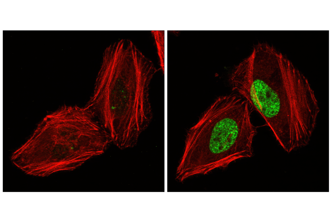 Immunofluorescence Image 1: Phospho-Histone H2A.X (Ser139) (20E3) Rabbit mAb