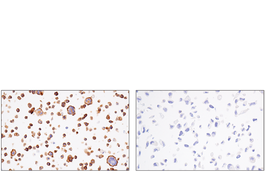 Immunohistochemistry Image 6: Semaphorin-4D/CD100 (E5C3B) XP<sup>®</sup> Rabbit mAb