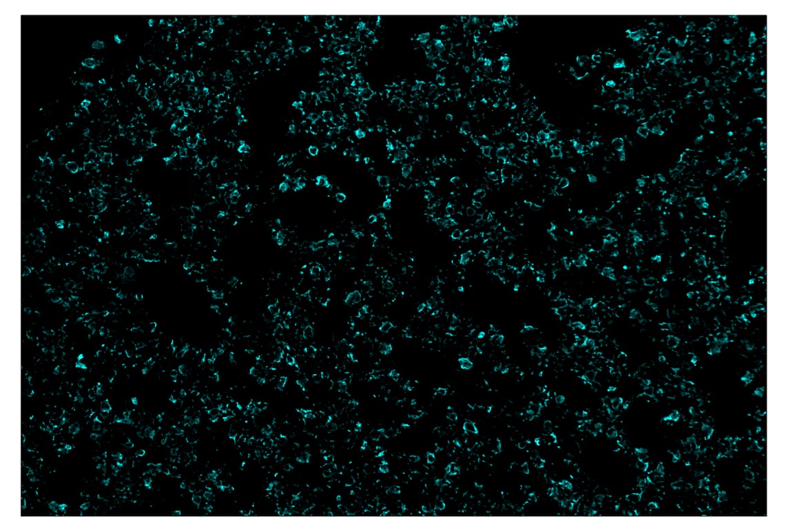 Immunohistochemistry Image 5: Pan-Keratin (Type I) (E6S1S) & CO-0072-594 SignalStar<sup>™</sup> Oligo-Antibody Pair