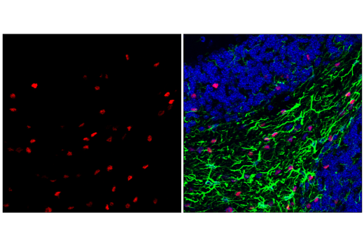 Immunofluorescence Image 2: Olig2 (E6G6Q) XP<sup>®</sup> Rabbit mAb (BSA and Azide Free)