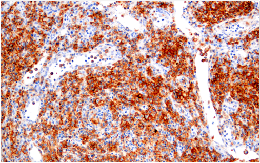 Immunohistochemical analysis of paraffin-embedded spleen using FoxP3 (D6O8R) Rabbit mAb