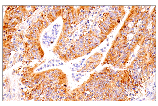 Immunohistochemistry Image 2: G3BP1 (E9G1M) XP<sup>®</sup> Rabbit mAb