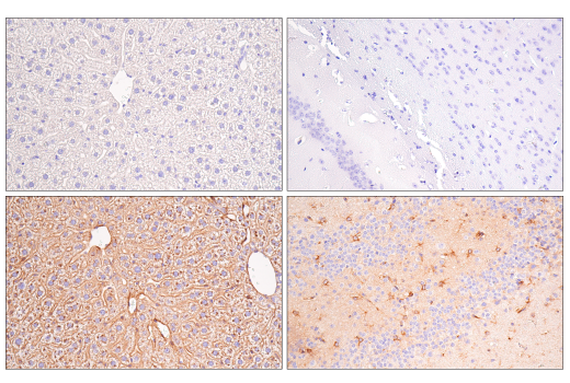 undefined Image 28: Late-Onset Alzheimer's Disease Risk Gene Antibody Sampler Kit