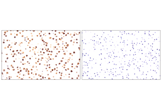 Immunohistochemistry Image 3: TNFRSF8/CD30 (E7E4D) XP<sup>®</sup> Rabbit mAb (BSA and Azide Free)