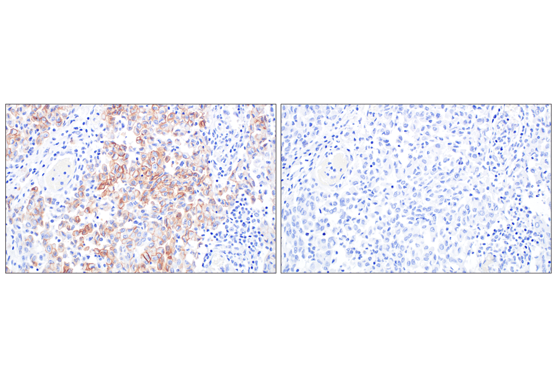 Immunohistochemistry Image 3: UPK3B (DBRRM3.66) Rabbit mAb