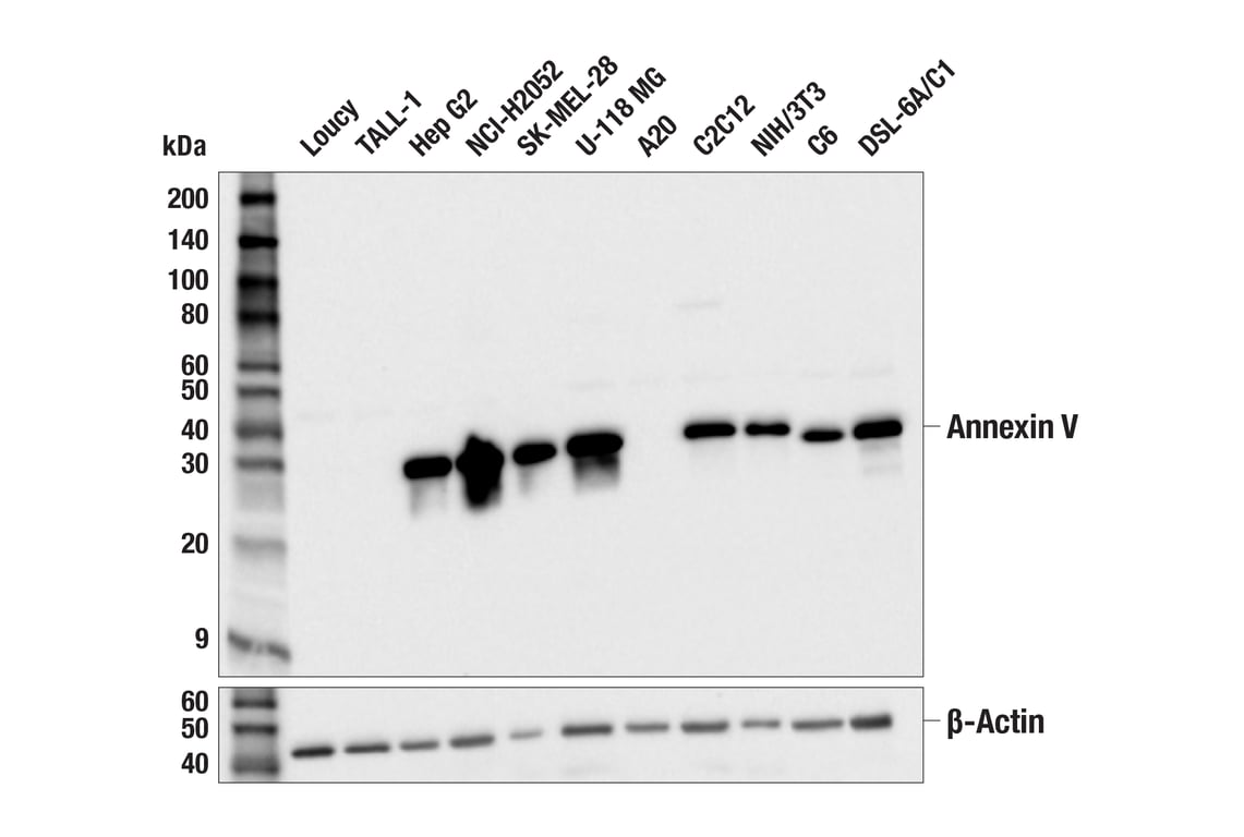 Western Blotting Image 1: Annexin V (E3W8V) Rabbit mAb (BSA and Azide Free)