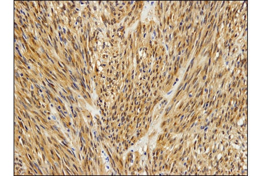 Immunohistochemistry Image 2: PKCθ (E1I7Y) Rabbit mAb (BSA and Azide Free)