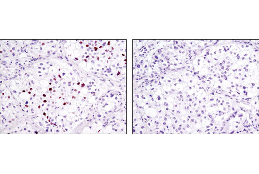 Immunohistochemistry Image 3: Phospho-Rb (Ser807/811) (D20B12) XP<sup>®</sup> Rabbit mAb (BSA and Azide Free)