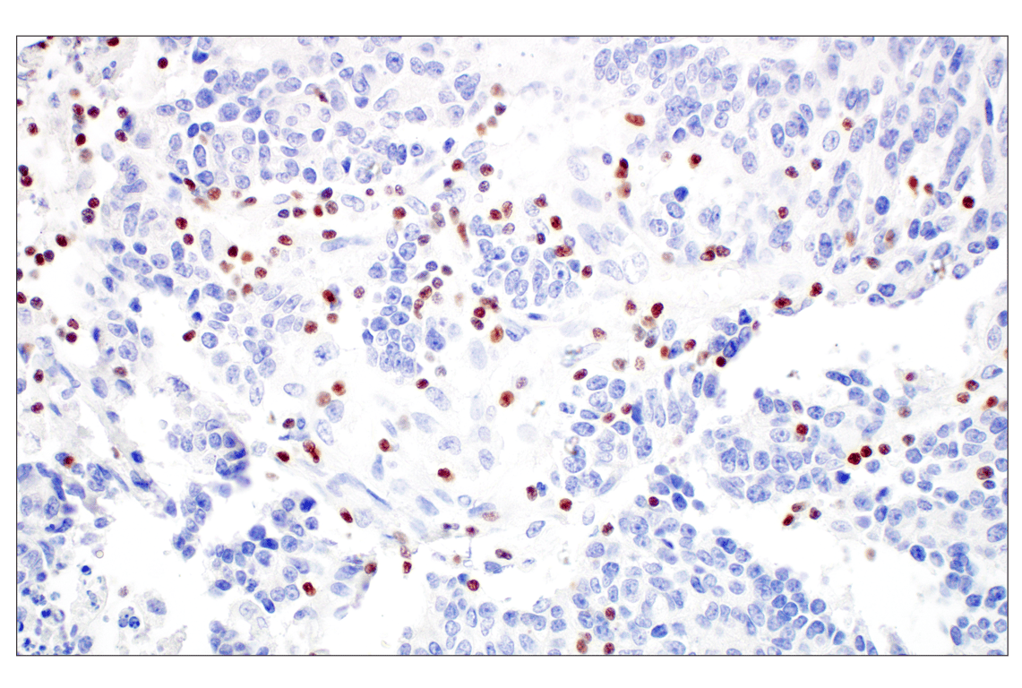 Immunohistochemistry Image 3: T-bet/TBX21 (E4I2K) Rabbit mAb