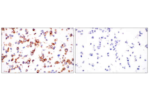 Immunohistochemistry Image 1: ACE2 (OTI1G4) Mouse mAb