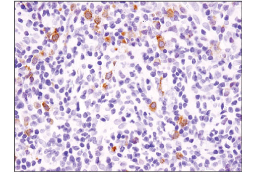 Immunohistochemistry Image 3: BLNK (D3P2H) XP<sup>®</sup> Rabbit mAb (BSA and Azide Free)