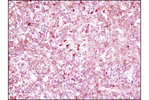 Immunohistochemistry Image 3: NFAT1 (D43B1) XP<sup>®</sup> Rabbit mAb