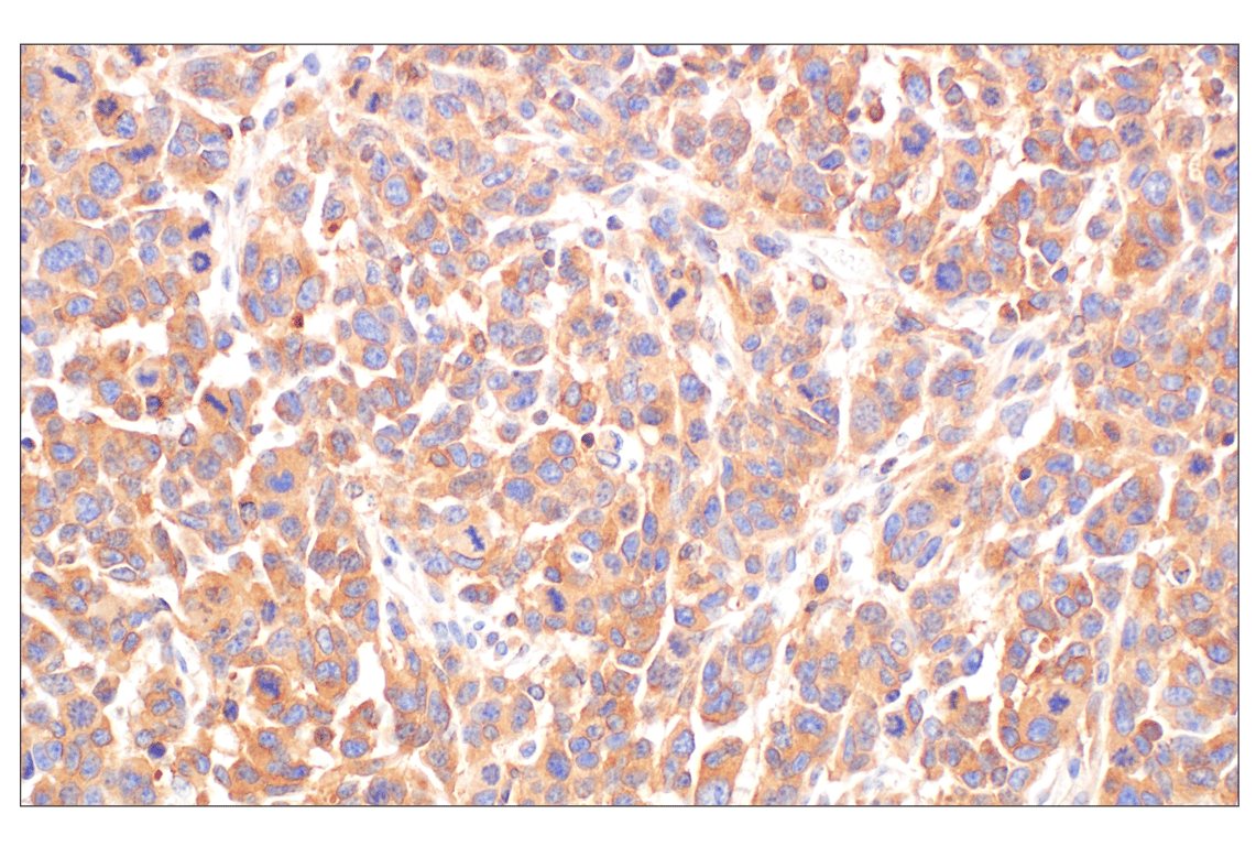 undefined Image 19: Rho-GTPase Antibody Sampler Kit