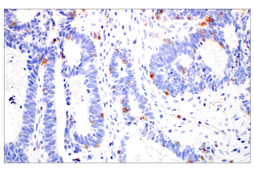 Immunohistochemistry Image 8: CD70 (E3Q1A) Rabbit mAb (BSA and Azide Free)