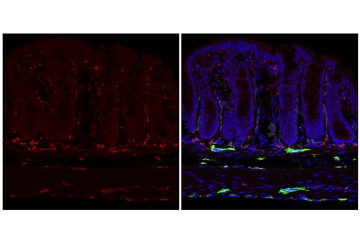 Immunofluorescence Image 3: CD68 (E3O7V) Rabbit mAb (Alexa Fluor<sup>®</sup> 647 Conjugate)