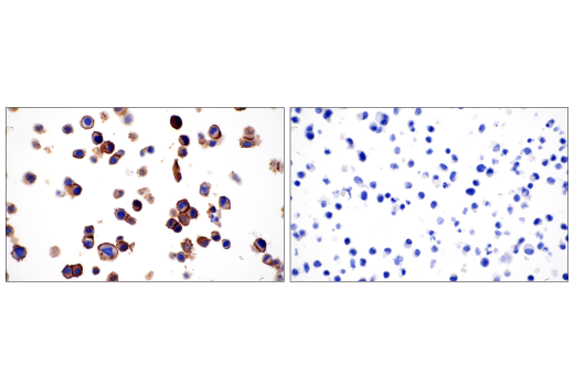 Immunohistochemistry Image 4: B7-H4 (D1M8I) XP<sup>®</sup> Rabbit mAb (BSA and Azide Free)