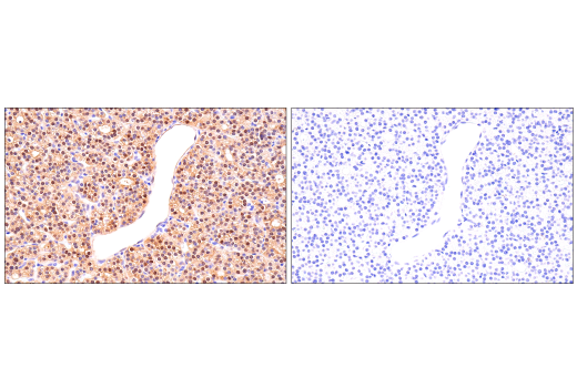 Immunohistochemistry Image 4: Parvalbumin (E8N2U) XP<sup>®</sup> Rabbit mAb