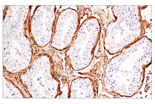 Immunohistochemistry Image 4: CD141/Thrombomodulin (E7Y9P) XP<sup>®</sup> Rabbit mAb (BSA and Azide Free)