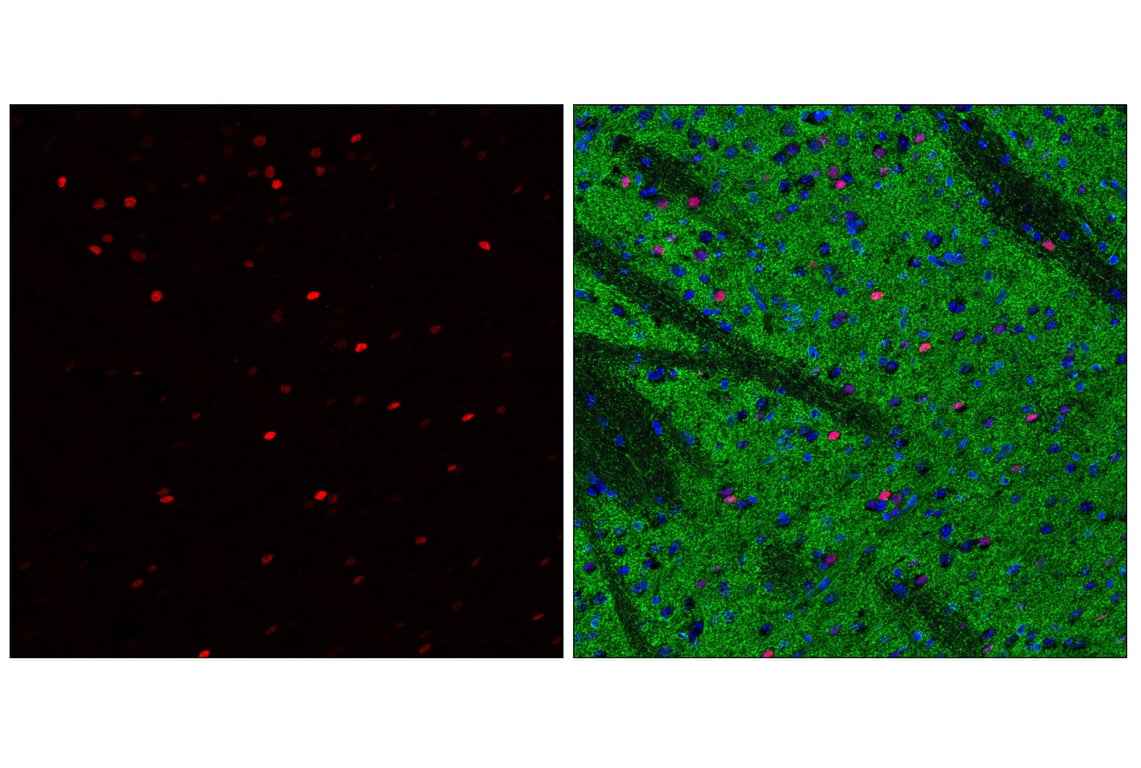 Immunofluorescence Image 1: c-Fos (E2I7R) XP<sup>®</sup> Rabbit mAb