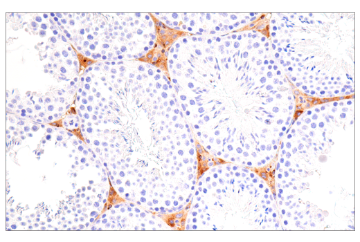 undefined Image 25: Late-Onset Alzheimer's Disease Risk Gene (Mouse Model) Antibody Sampler Kit
