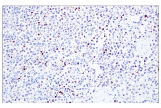 undefined Image 9: Human Exhausted CD8<sup>+</sup> T Cell IHC Antibody Sampler Kit