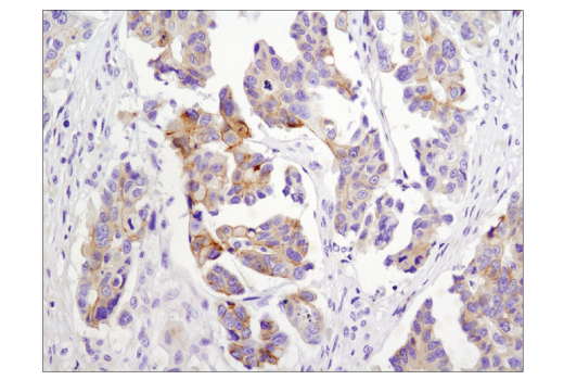 Immunohistochemistry Image 1: N-Cadherin (D4R1H) XP<sup>®</sup> Rabbit mAb (BSA and Azide Free)