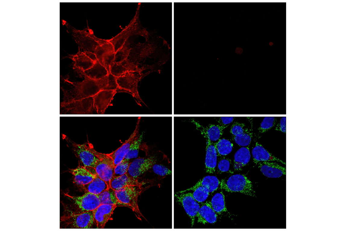 Immunofluorescence Image 1: DYKDDDDK Tag (D6W5B) Rabbit mAb (Binds to same epitope as Sigma-Aldrich Anti-FLAG M2 antibody) (Alexa Fluor<sup>®</sup> 594 Conjugate)