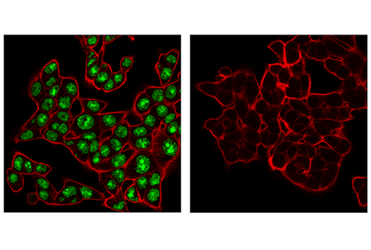 Immunofluorescence Image 1: ADAR1 (E6X9R) XP<sup>®</sup> Rabbit mAb