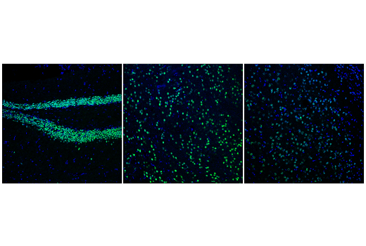 Immunofluorescence Image 2: Bcl-11B (D6F1) XP<sup>®</sup> Rabbit mAb (BSA and Azide Free)